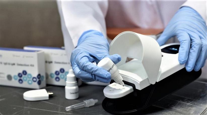Investigadores de la Universidad Nacional Chiao Tung de Taiwán (NCTU) han desarrollado una prueba rápida de COVID-19 que puede detectar la etapa de la infección de un individuo y producir resultados en menos de cinco minutos.