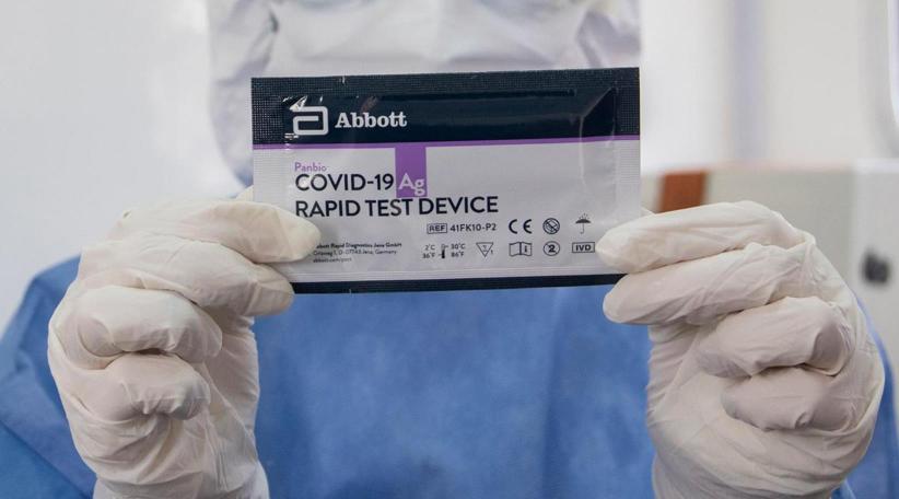 Argentina aprueba la venta en farmacias de autotests de coronavirus