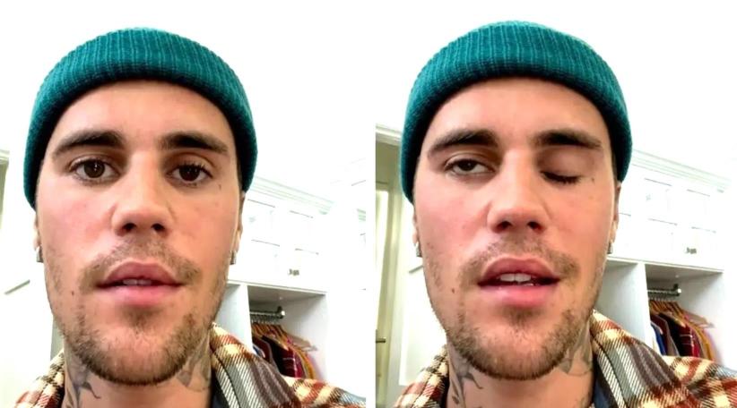 Justin Bieber cancela su gira después que la mitad de la cara le queda paralizada por un virus