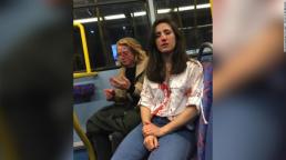 Pareja de lesbianas fue golpeada brutalmente en un  ataque homofóbico en Londres