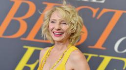 Anne Heche in hospital, ‘stable’ after fiery car crash